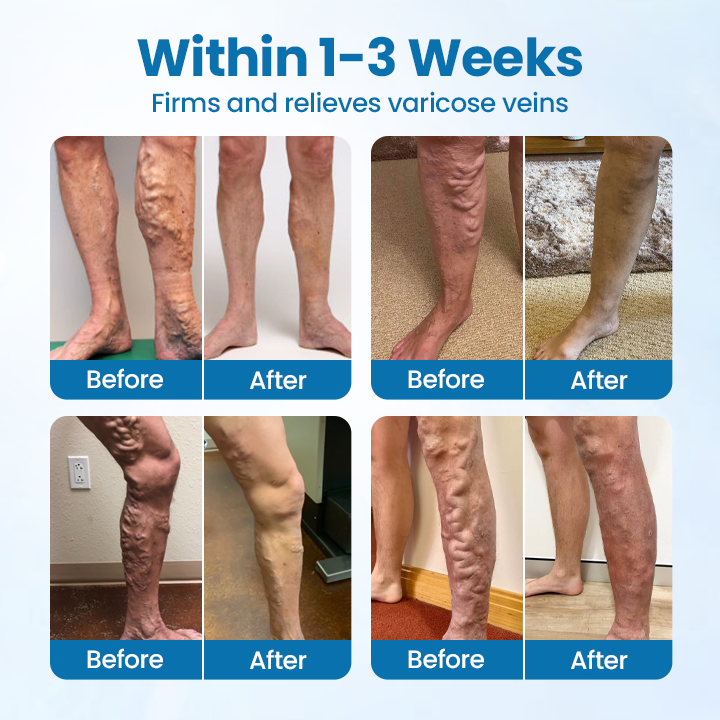 Timilk® VeinGuard Herbal Spray.