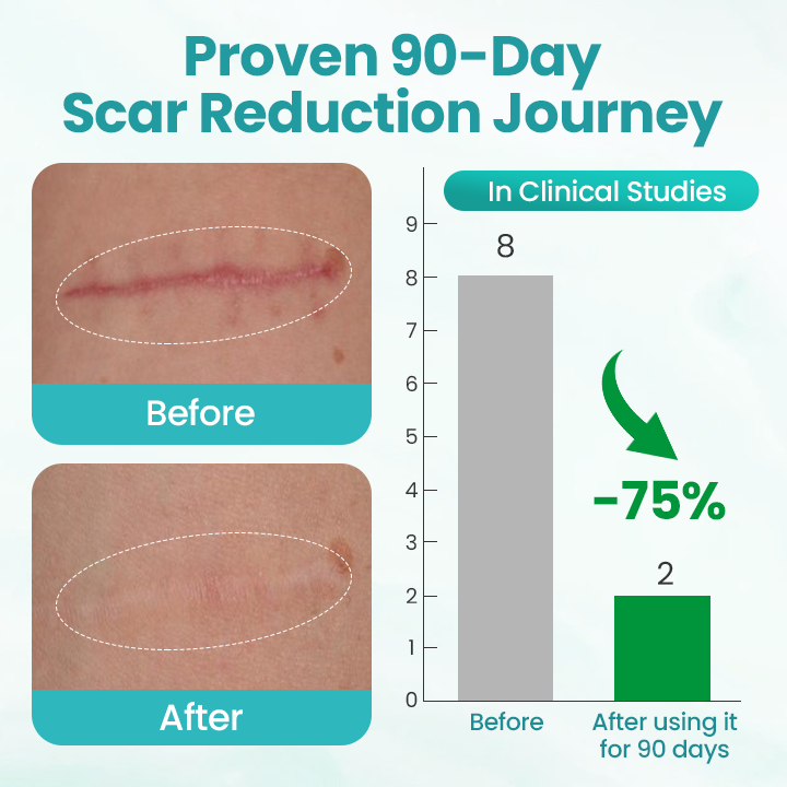 Timilk® EliteAloe ScarSolve Spray.