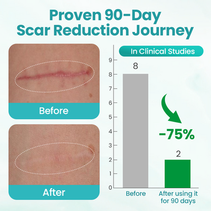 Timilk® EliteAloe ScarSolve Spray.