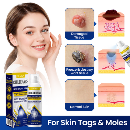 Timilk® ChillErase Bump Renewal Spray.