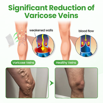 Healrize® VeinHeal Microneedle Patch.