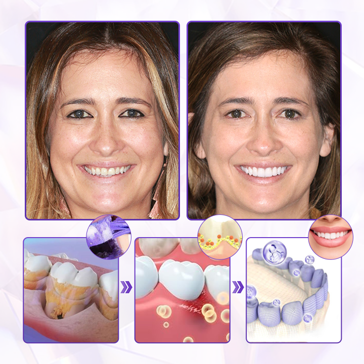 Biancat® BeeRenew Advanced Gum Healing Toothpaste.