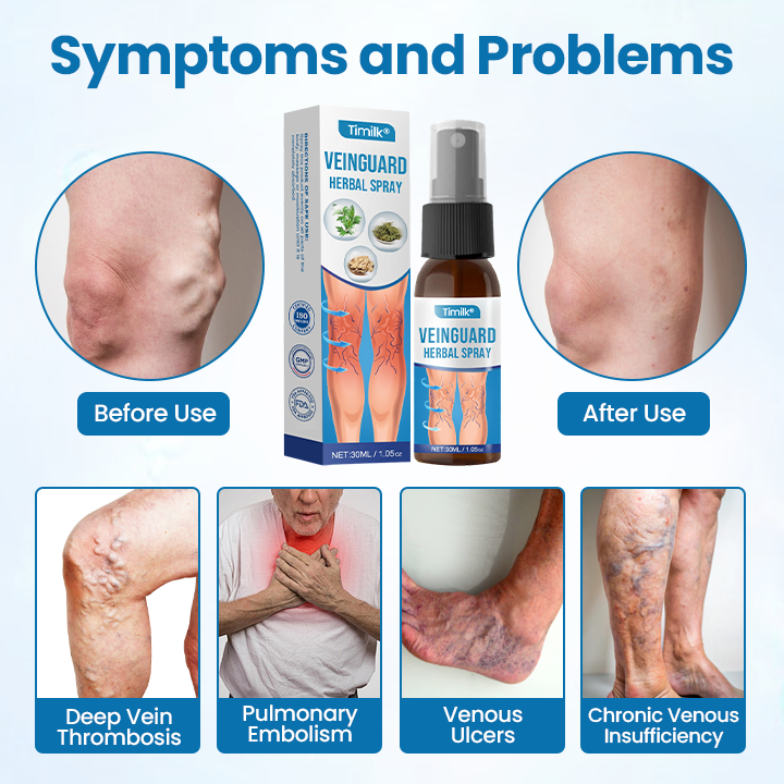 Timilk® VeinGuard Herbal Spray.
