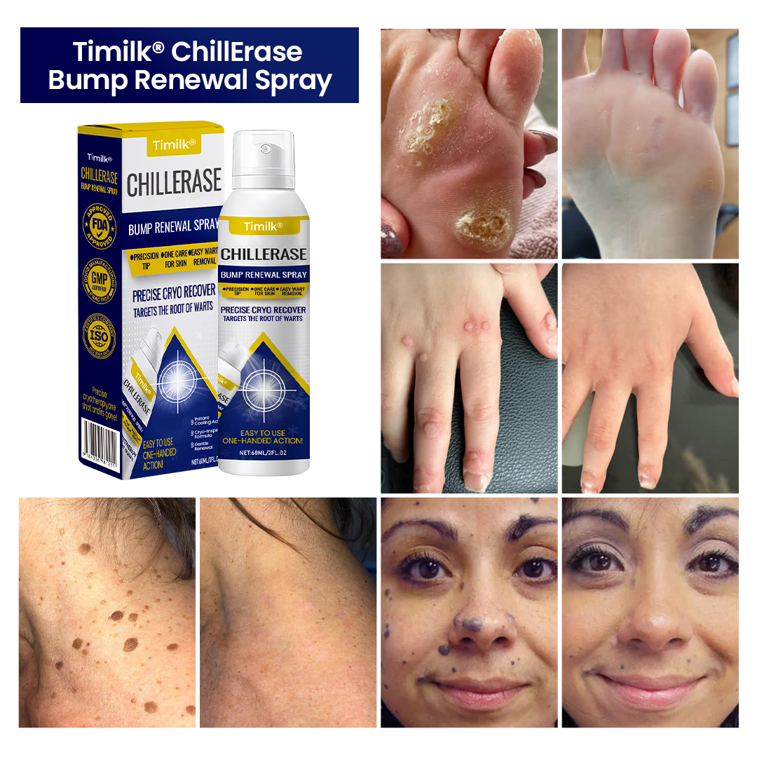 Timilk® ChillErase Bump Renewal Spray.