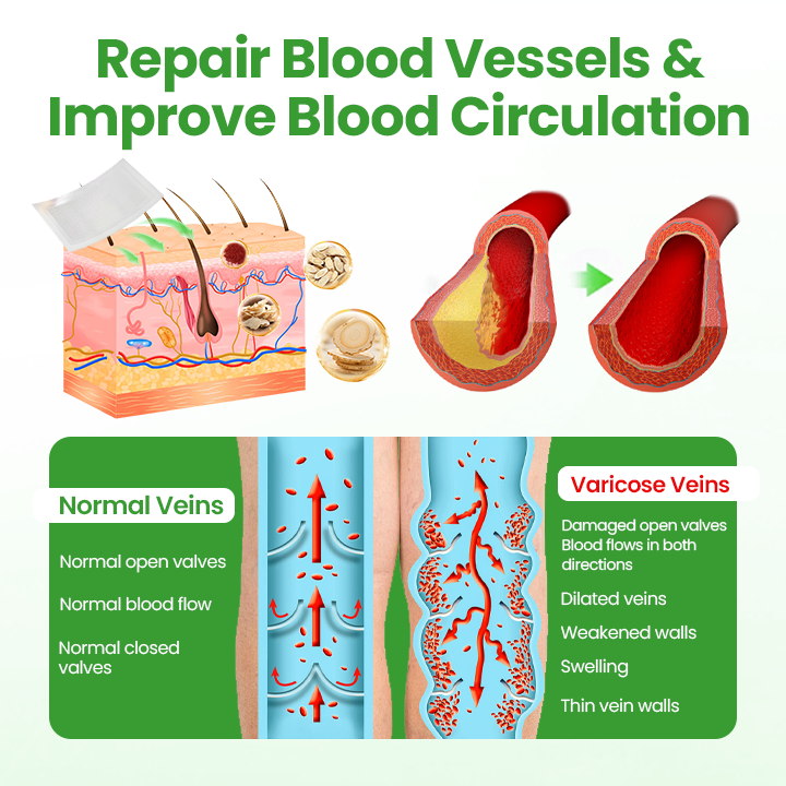 Healrize® VeinHeal Microneedle Patch.