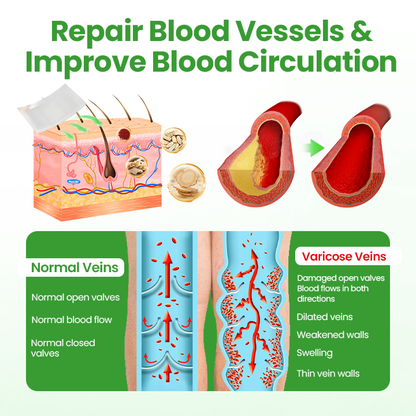 Healrize® VeinHeal Microneedle Patch.